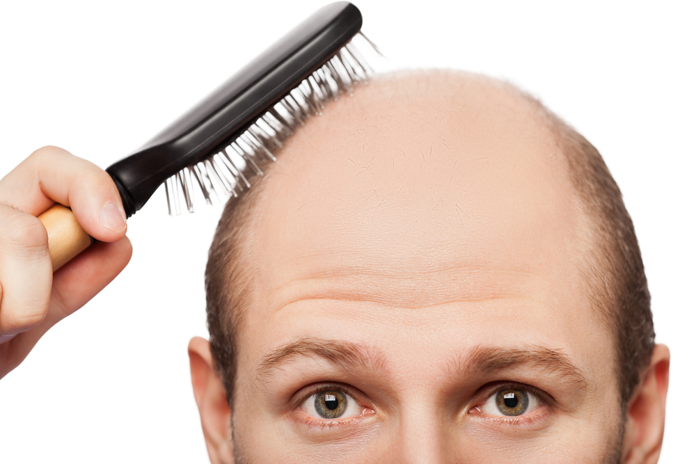 髪の毛のチリチリは治せる 考えられる原因とそれぞれの対処法 男の悩み解決治療院in大阪
