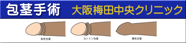 包茎手術大阪梅田中央クリニック
