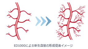 eｄ1000血管再生イメージ