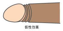 仮性包茎