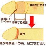 陰茎増大（竿を太く）についてのお話